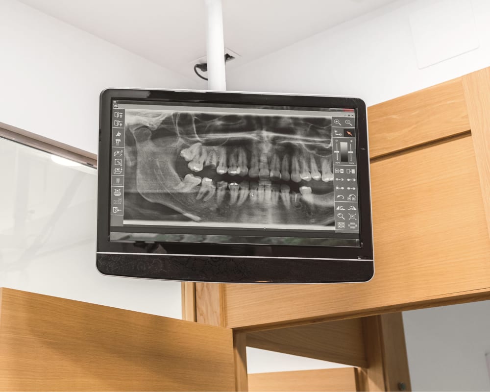 Dental Technology, Fernie Dentist